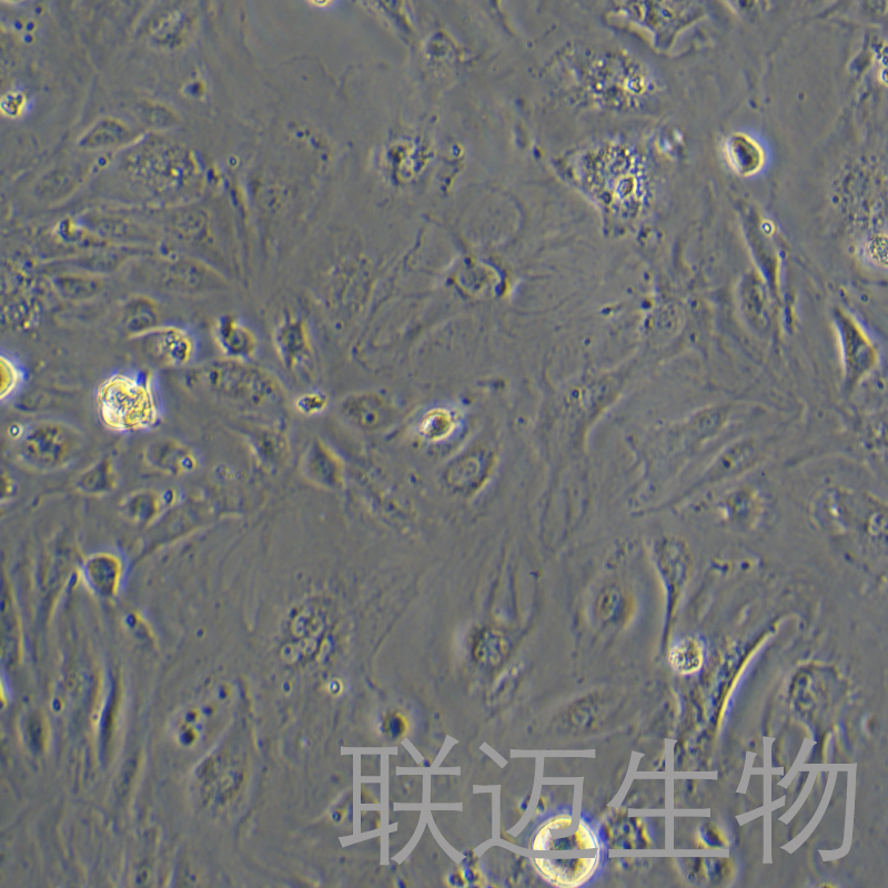 hcaec细胞（人冠状动脉内皮细胞）LM8C2160