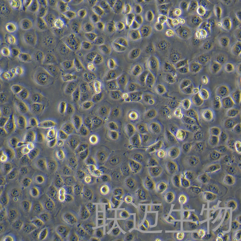 HCoEpiC细胞（人正常结肠上皮细胞）LM8C2118