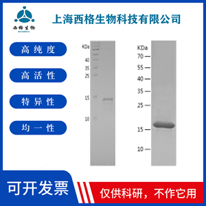 Recombinant Human Fibronectin