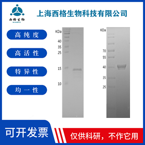 Recombinant Human Secretory lectin ZG16