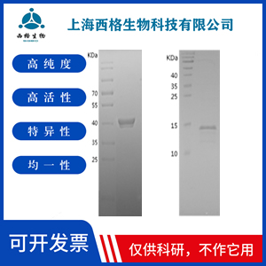 Recombinant Human Histone H2B