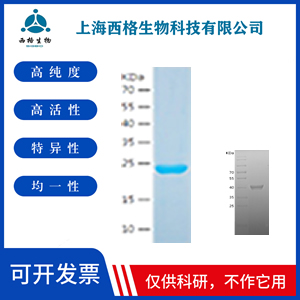 Recombinant Human DeSI-1