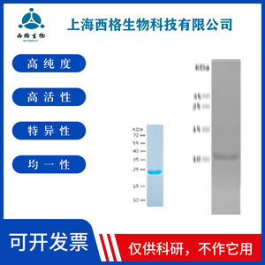 Recombinant Human Fibronectin
