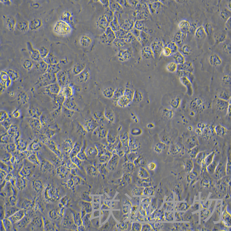 Hep 3B2.1-7细胞（人肝癌细胞）LM8C2209