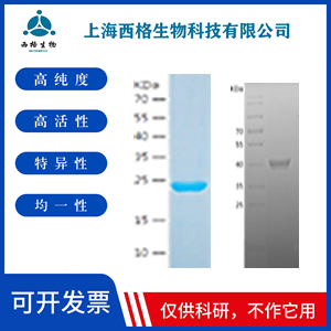 Recombinant Human Peroxiredoxin 5