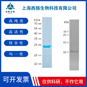 Recombinant Human Profilin 2