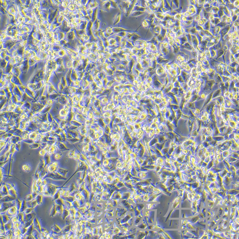 NCI-H1975-LUC细胞（人肺腺癌细胞-荧光素酶标记）LM8C0298-L