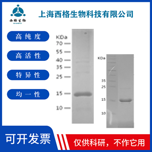 Recombinant Human SGLT2