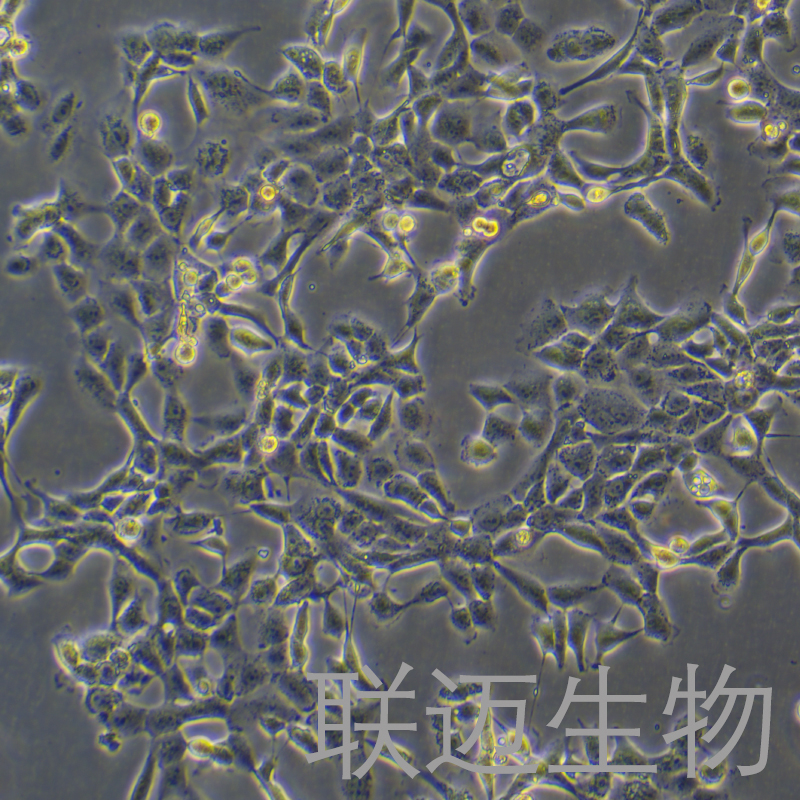 SUM149PT/GFP细胞（人乳腺癌细胞-绿色荧光标记）LM8C1477-G