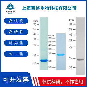 Recombinant Human AMPK alpha 1
