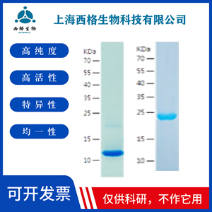 Recombinant Human CLIC5
