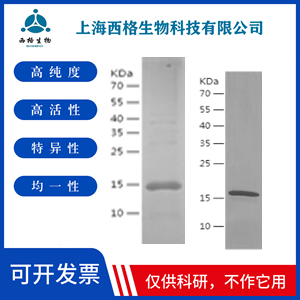 Recombinant Human AHA1