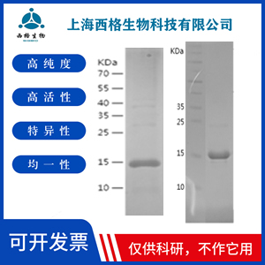 Recombinant Human beta Actin