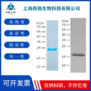 Recombinant Human AMPK alpha 1