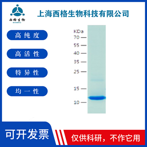 Recombinant Human CaMKII beta