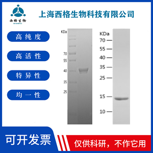 Recombinant Human C4 binding