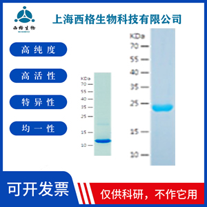 Recombinant Human Cathepsin L