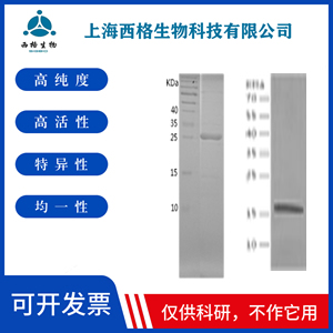 Recombinant Human CAPZA1
