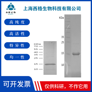 Recombinant Human Cytokeratin 18