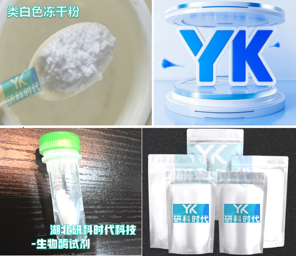 9028-38-0；D-3-羟丁酸脱氢酶-精品科研试剂-湖北研科时代科技-“研”无止境;“科”学创新！支持三方验证；支持定制；检测图谱；MSDS等技术支持！