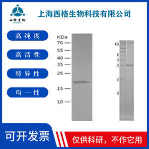 Recombinant Human DCTN6