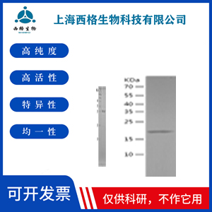 Recombinant Human DDAH1