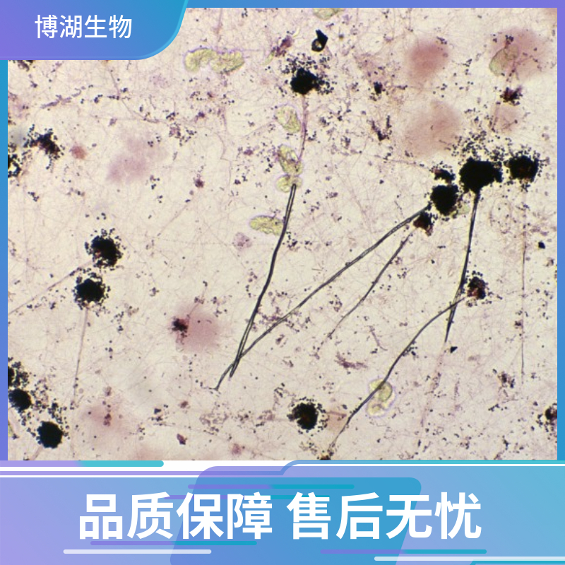 大鼠脊髓成纤维细胞