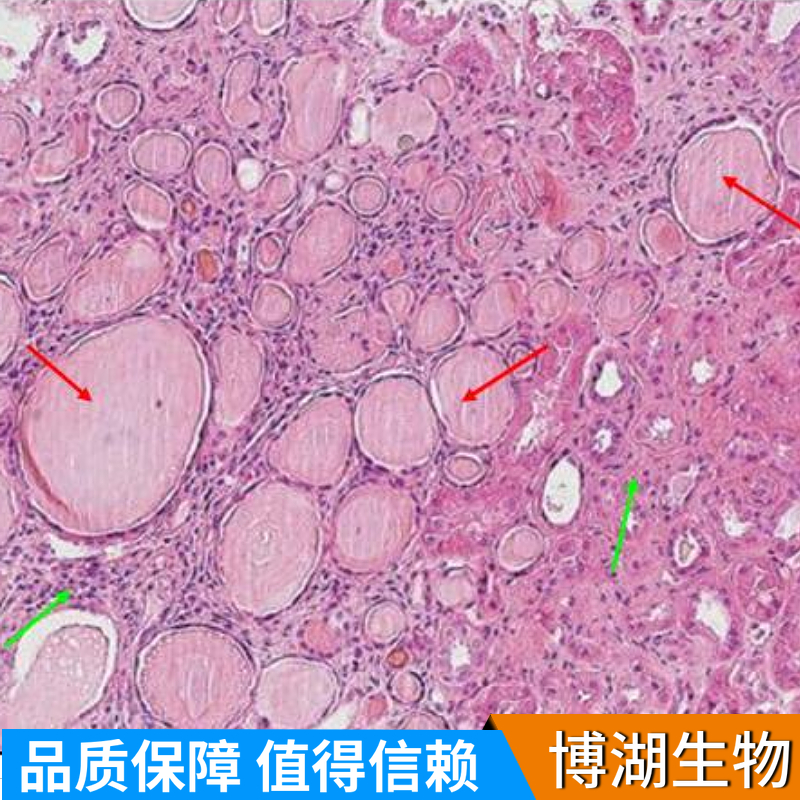 人脑微血管内皮细胞