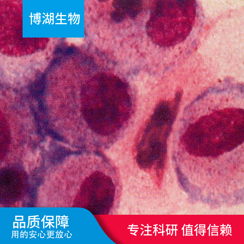 人胃黏膜上皮细胞