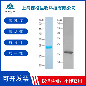 Recombinant Human Ephrin B2
