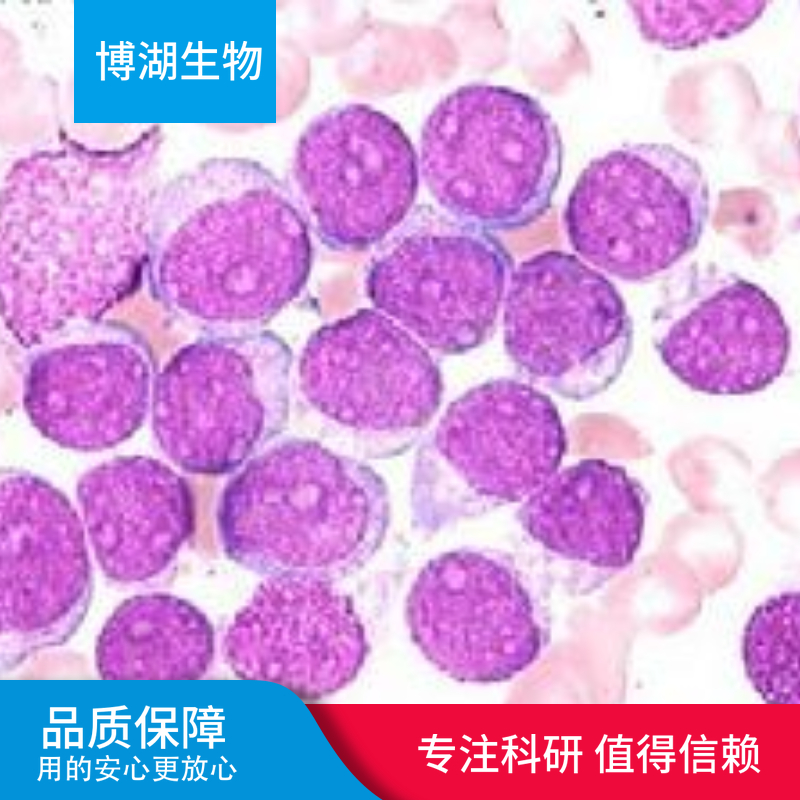 人椎间盘纤维环细胞