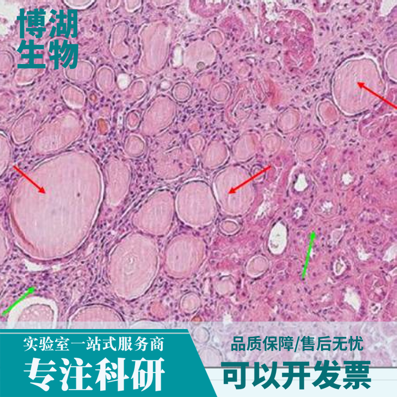 人子宫内膜基质细胞