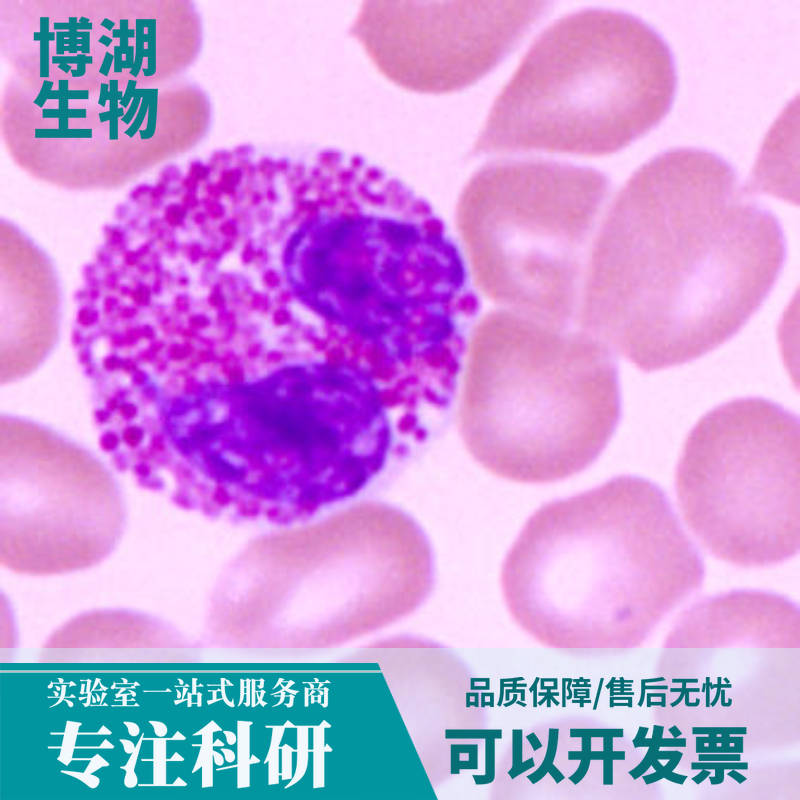 人子宫内膜间质细胞