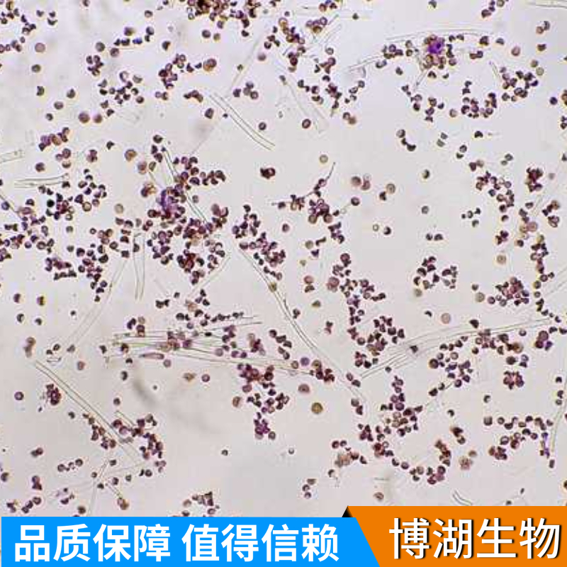 兔胎盘绒毛膜滋养层细胞