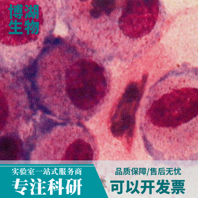 兔气管平滑肌细胞