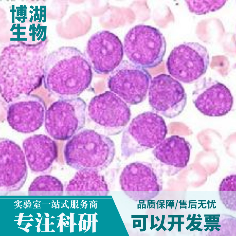 兔膀胱平滑肌细胞