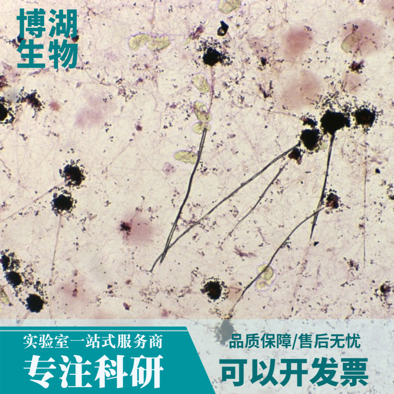 小鼠腹腔巨噬细胞