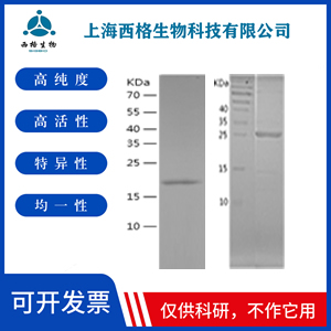 Recombinant Human Heme Oxygenase 1