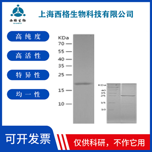 Recombinant Human HMGCS1