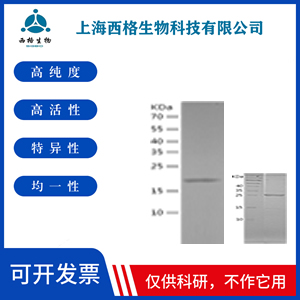 Recombinant Human NPY