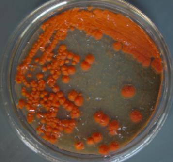 Paenibacillus Larvae