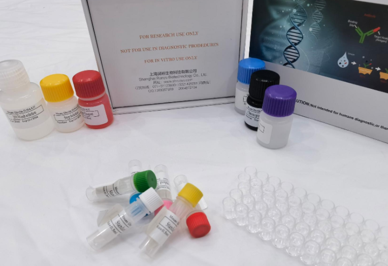 人基质γ羧基谷氨酸蛋白（MGP）ELISA试剂盒