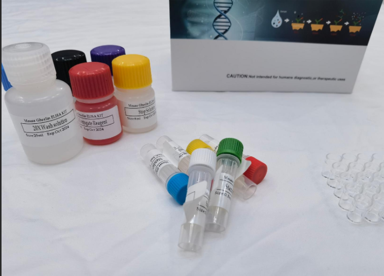 人抗磷脂酰甘油IgG抗体（PG-IgG）ELISA试剂盒