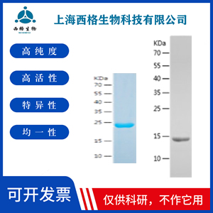 Recombinant Human Prolactin