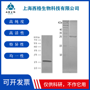 Recombinant Human Triosephosphate isomerase