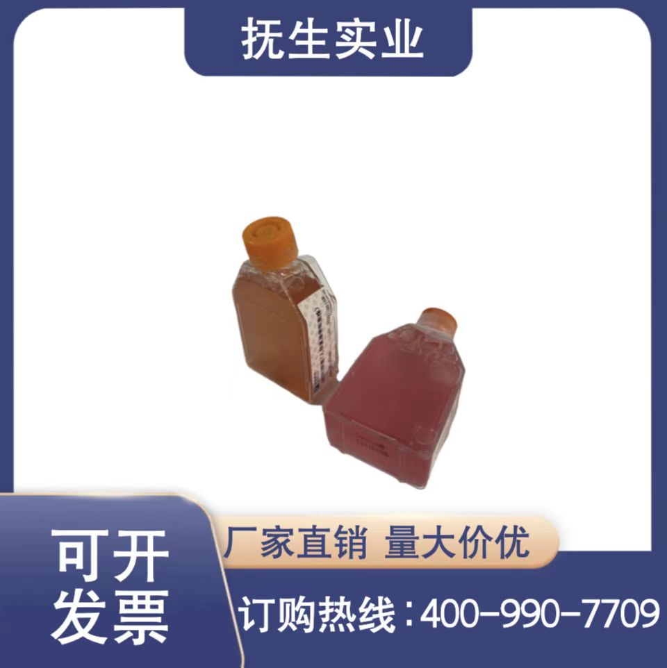 人Ⅱ型肺泡上皮细胞