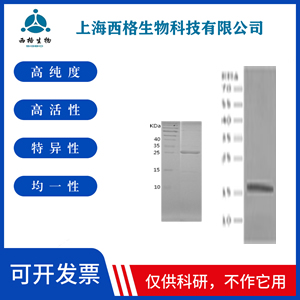 Recombinant Human Vimentin