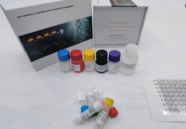 人EB病毒IgG抗体（Ebv IgG）ELISA试剂盒