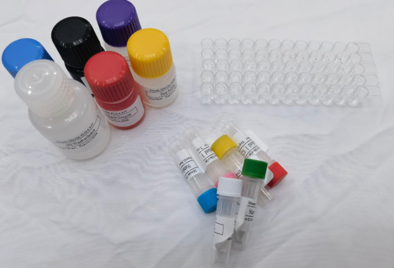 人水痘带状疱疹病毒IgG抗体（VZV-IgG）ELISA试剂盒