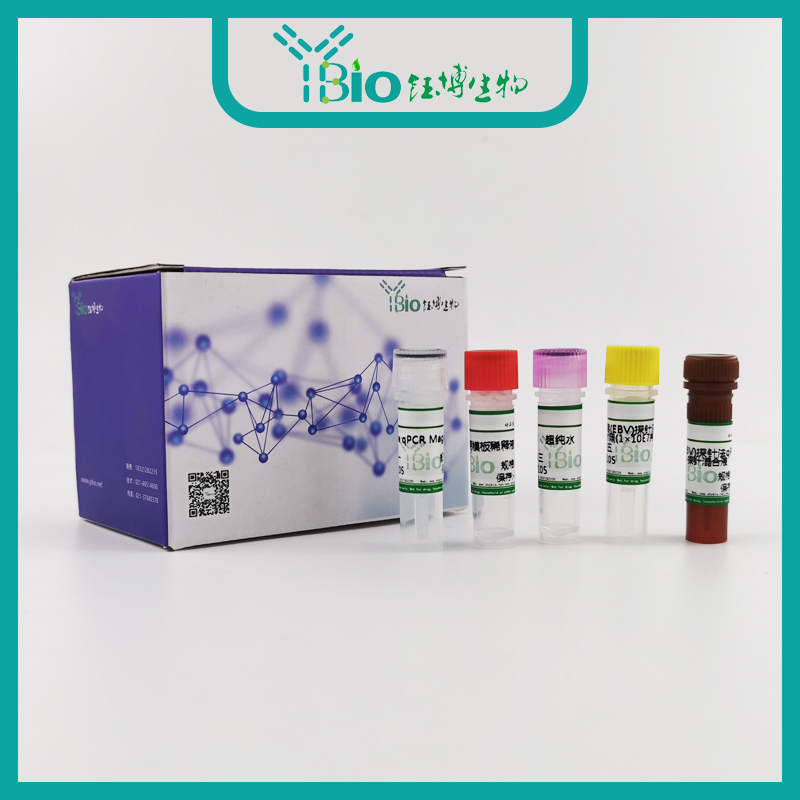 Human T-cell Lymphoma Virus Provirus(HTLV-2)人类嗜T淋巴细胞病毒2型前病毒染料法荧光定量PCR试剂盒 YB-70559DPR